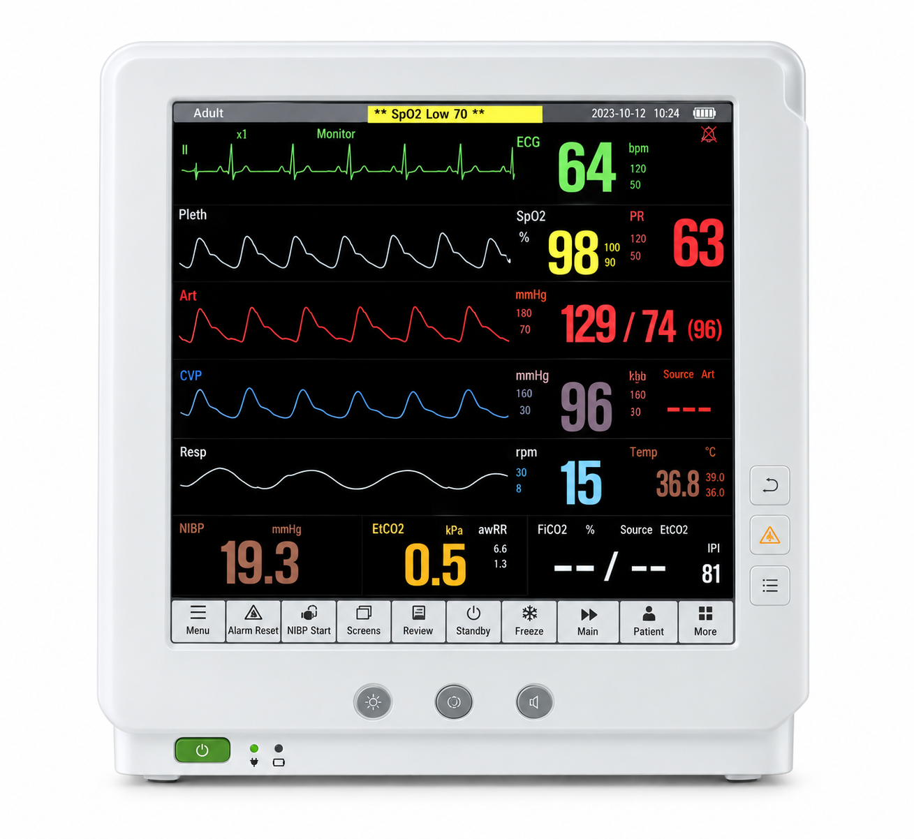 Monitor Multiparâmetros LiFEtouch M15